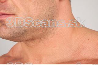 Neck texture of Gene 0001